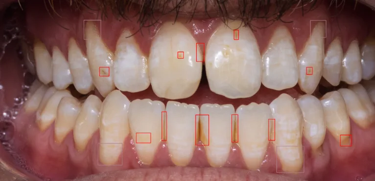 Fig 6