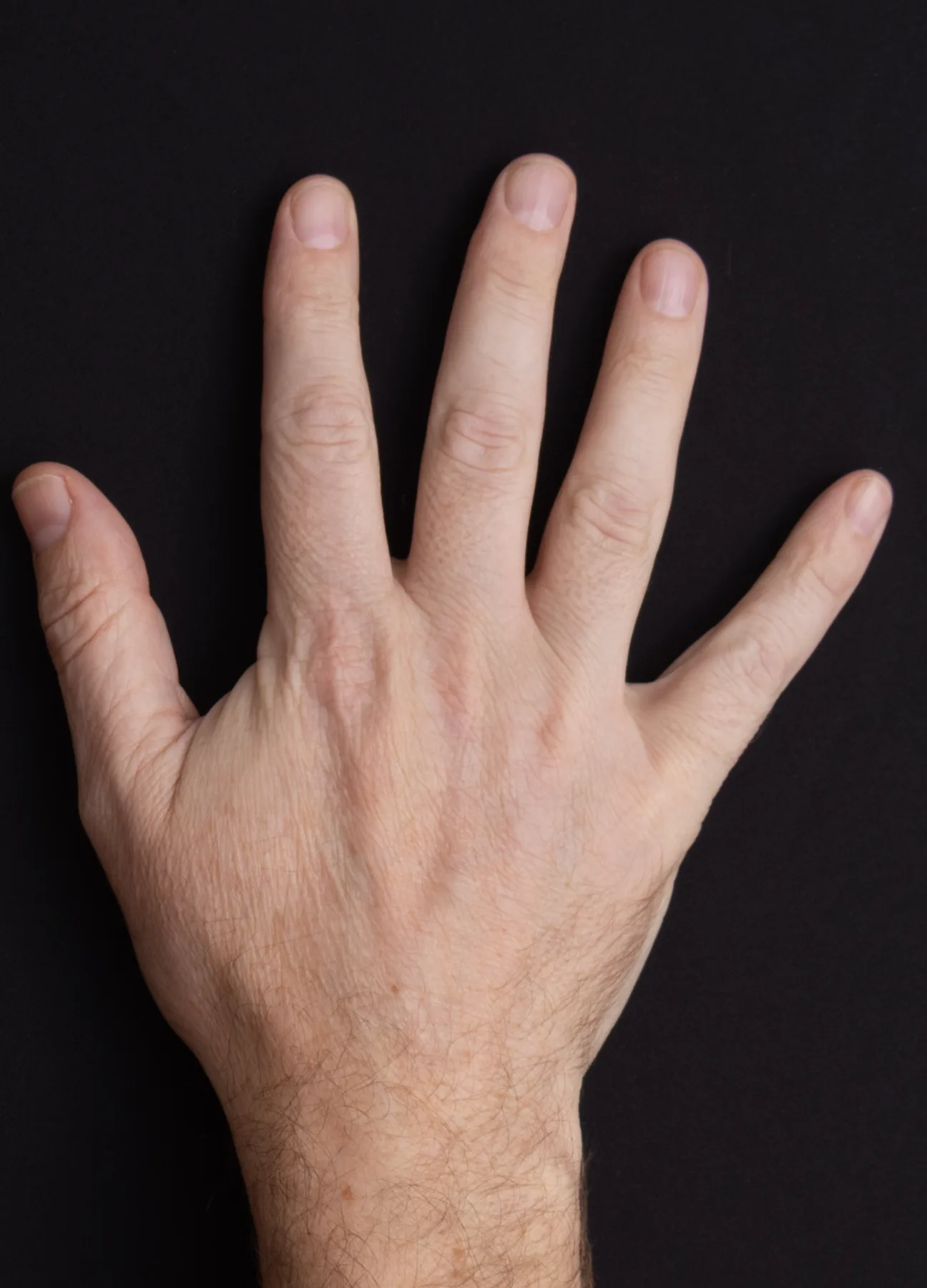 Hands