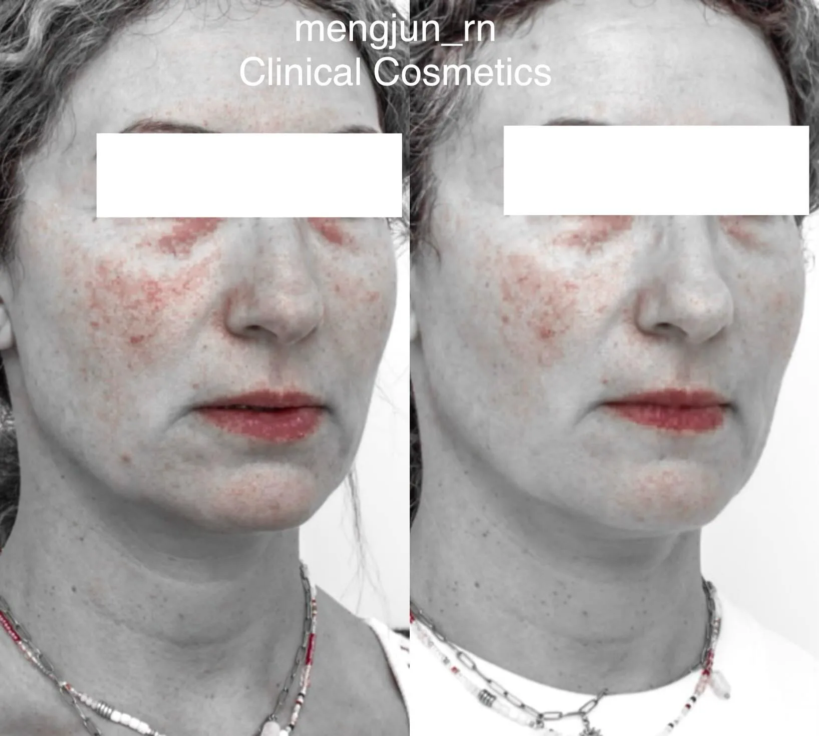 Case 27