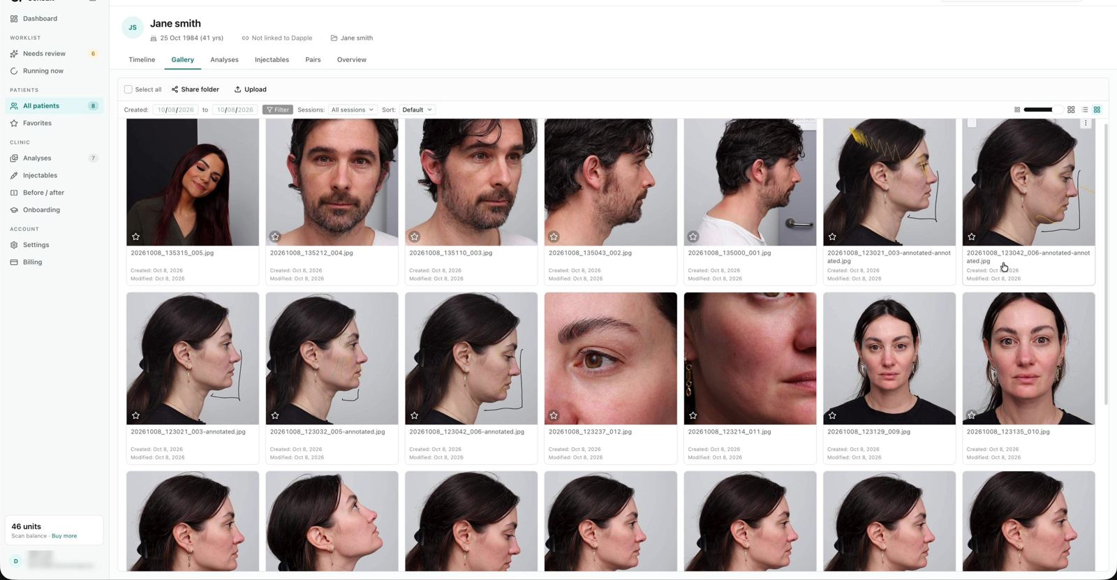 Patient gallery