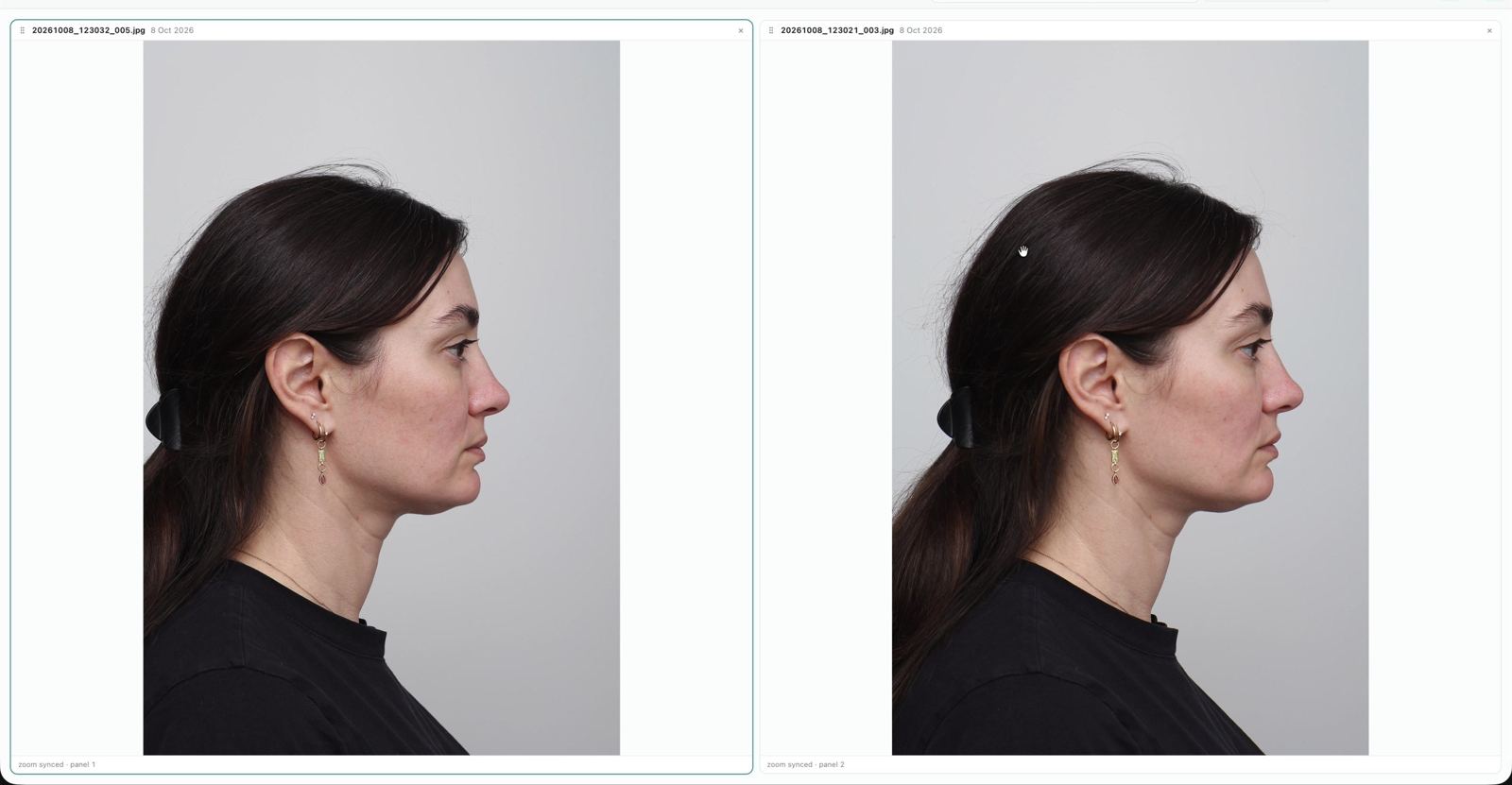 Comparison view