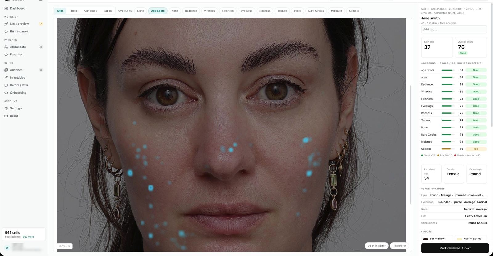 Skin visualisation