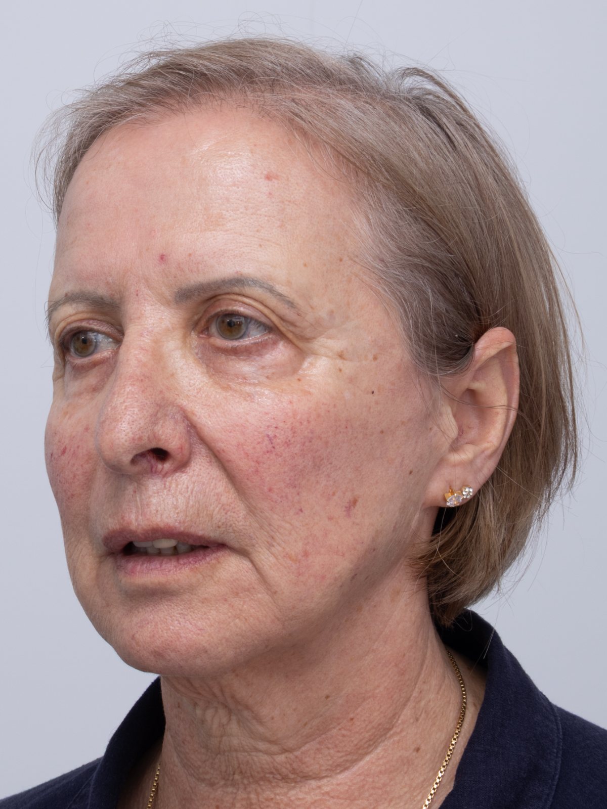 Clinical Imaging capture, fixed distance and calibrated lighting